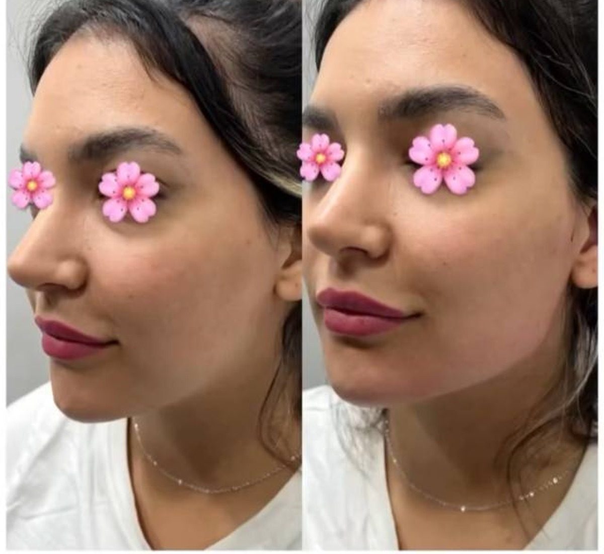 نمونه کار تعادل فرم چهره